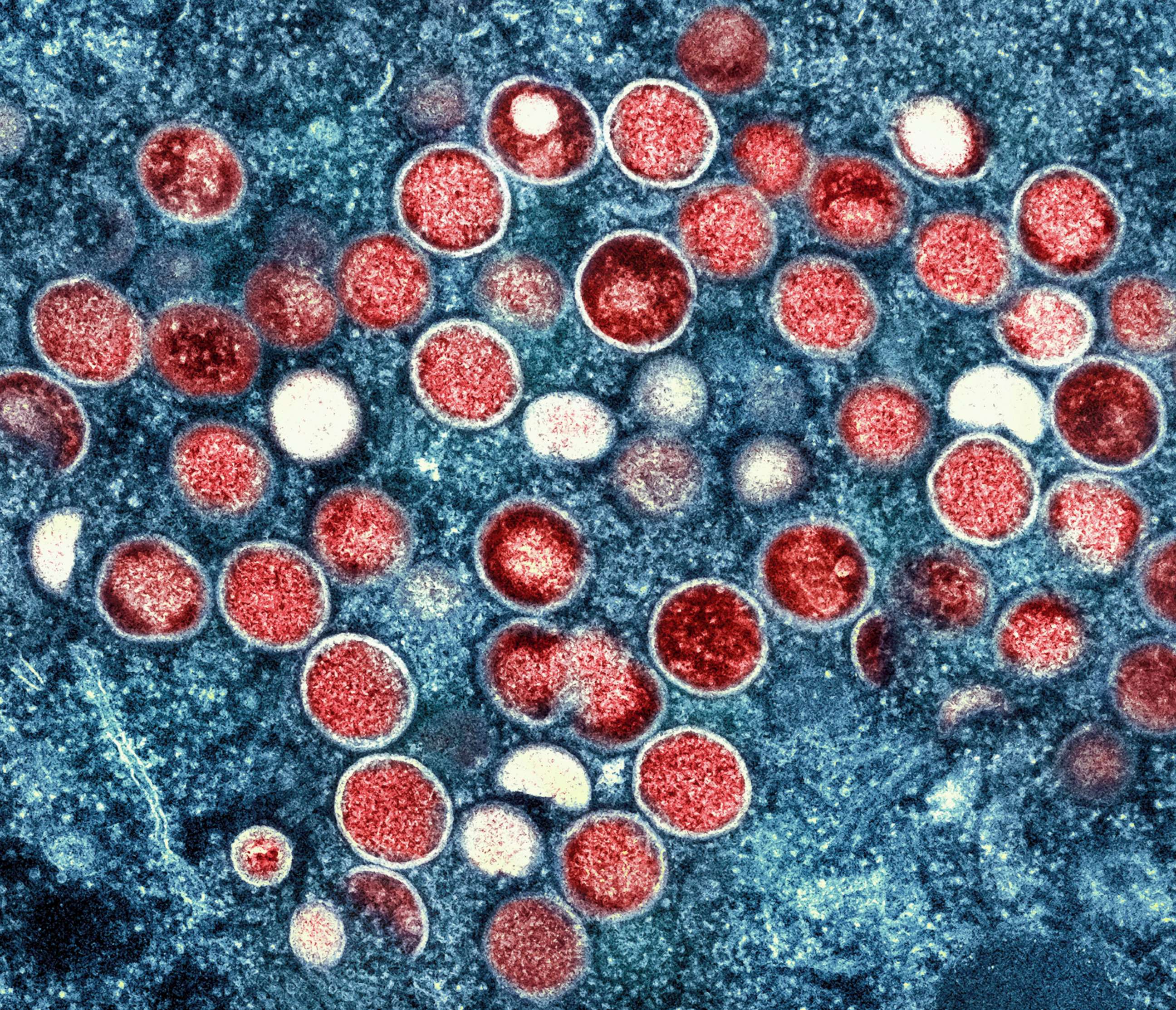PHOTO: A colorized transmission electron micrograph shows monkeypox particles (red) found within an infected cell (blue), cultured in the laboratory that was captured and color-enhanced at the NIAID Integrated Research Facility in Fort Detrick, Md.