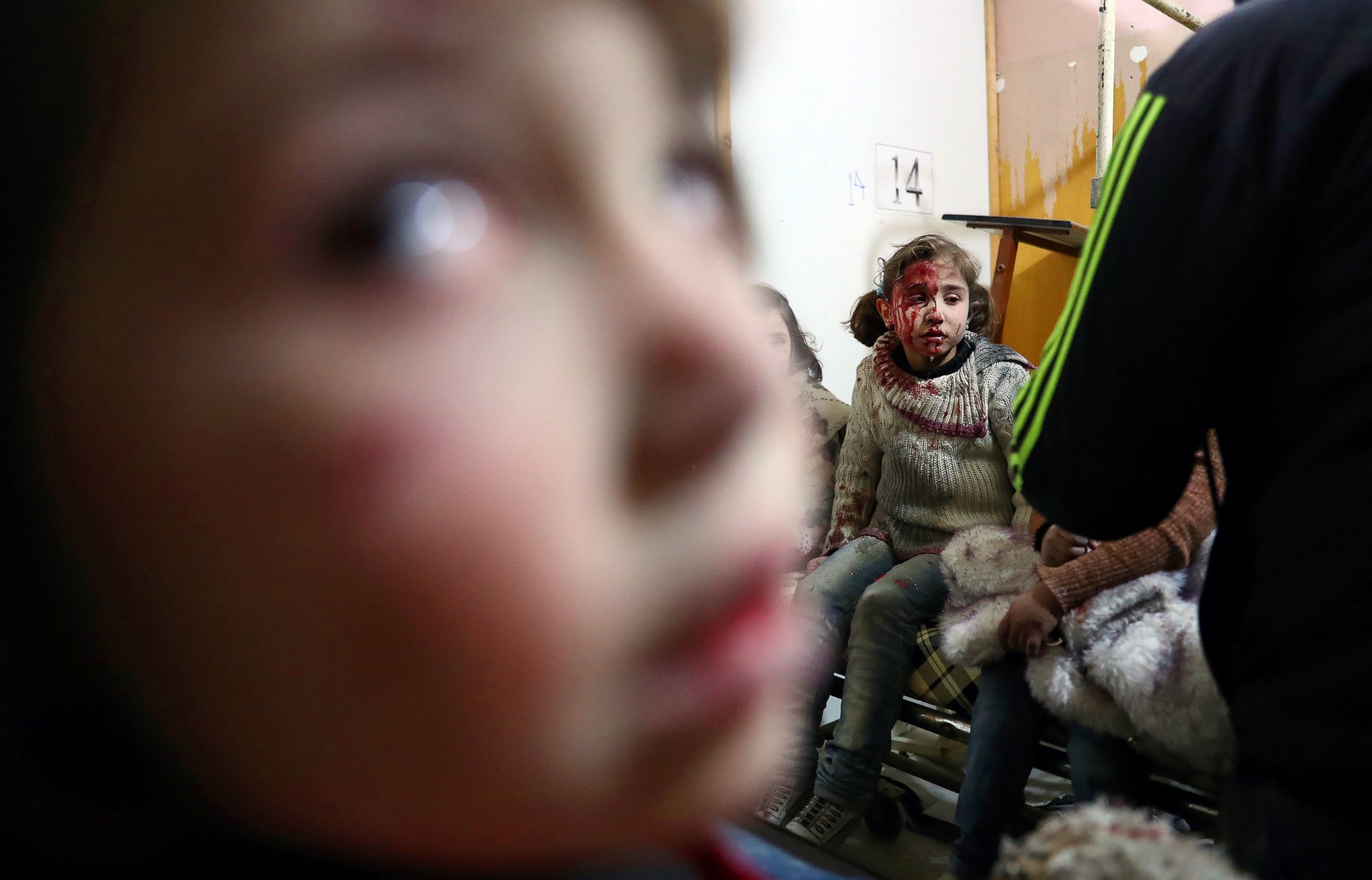 PHOTO: Wounded Syrian girls await treatment at a make-shift hospital following reported government airstrike on the rebel-held town of Douma, on the eastern outskirts of the capital Damascus, Feb. 25, 2017.
