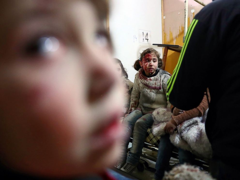 PHOTO: Wounded Syrian girls await treatment at a make-shift hospital following reported government airstrike on the rebel-held town of Douma, on the eastern outskirts of the capital Damascus, Feb. 25, 2017.