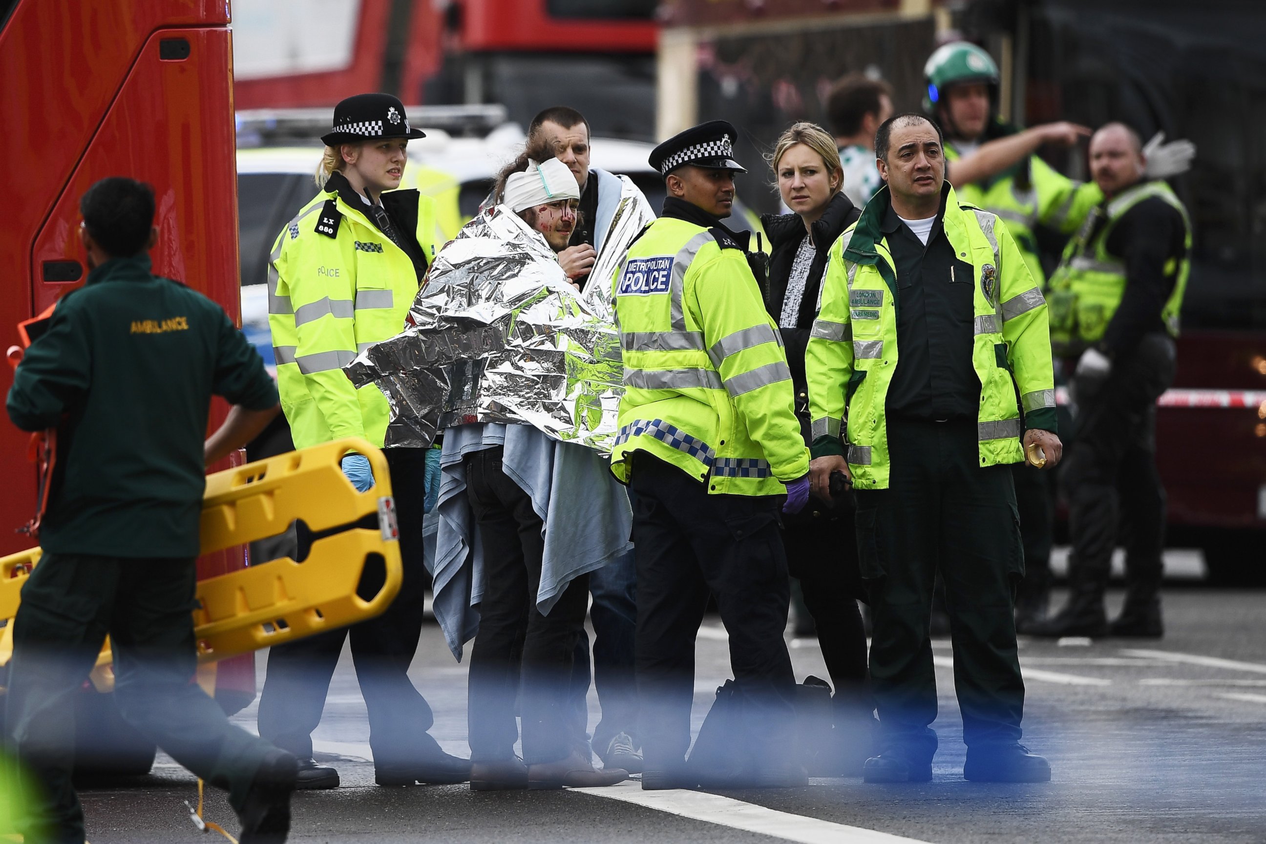 PHOTO: A member of the public is treated by emergency services near Westminster Bridge and the Houses of Parliament on March 22, 2017 in London.
