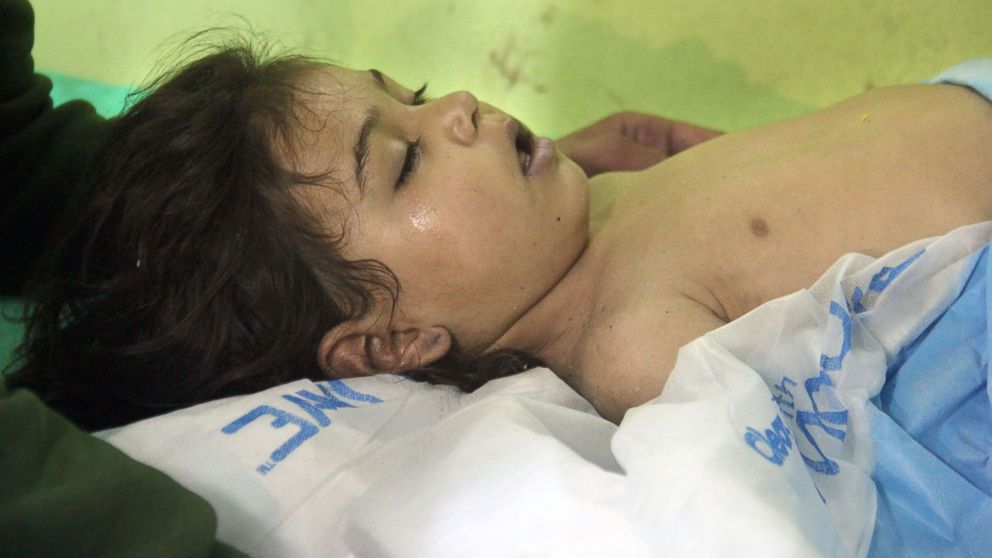 An unconscious Syrian child receives treatment at a hospital in Khan Sheikhun, a rebel-held town in the northwestern Syrian Idlib province, following a suspected chemical attack on April 4, 2017.
