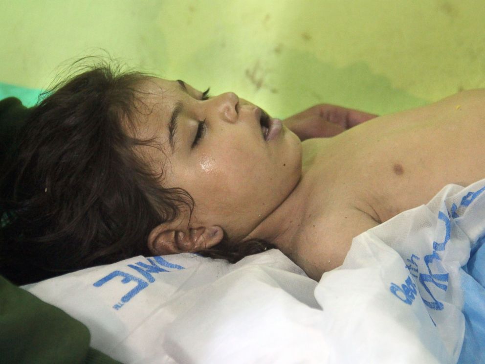 PHOTO: An unconscious Syrian child receives treatment at a hospital in Khan Sheikhun, a rebel-held town in the northwestern Syrian Idlib province, following a suspected chemical attack on April 4, 2017.
