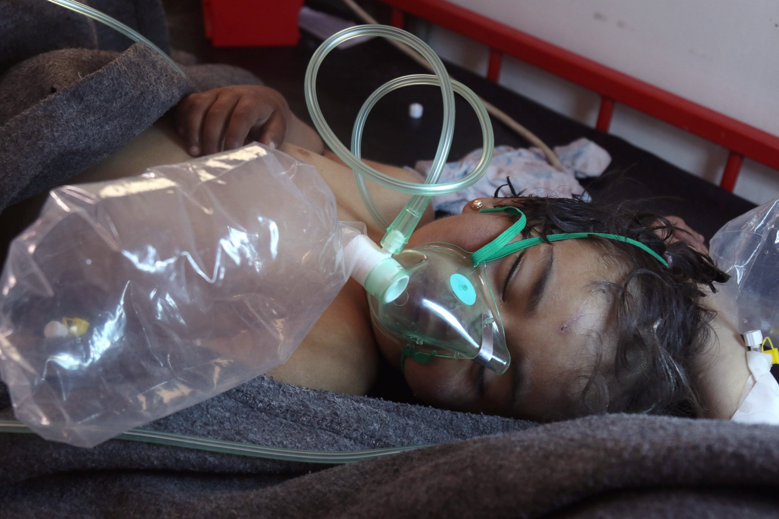 PHOTO: A Syrian child receives treatment at a small hospital in the town of Maaret al-Noman following a suspected chemical attack in Khan Sheikhun, Syria, on April 4, 2017.