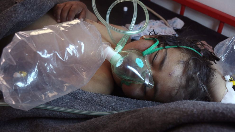 PHOTO: A Syrian child receives treatment at a small hospital in the town of Maaret al-Noman following a suspected chemical attack in Khan Sheikhun, Syria, on April 4, 2017.