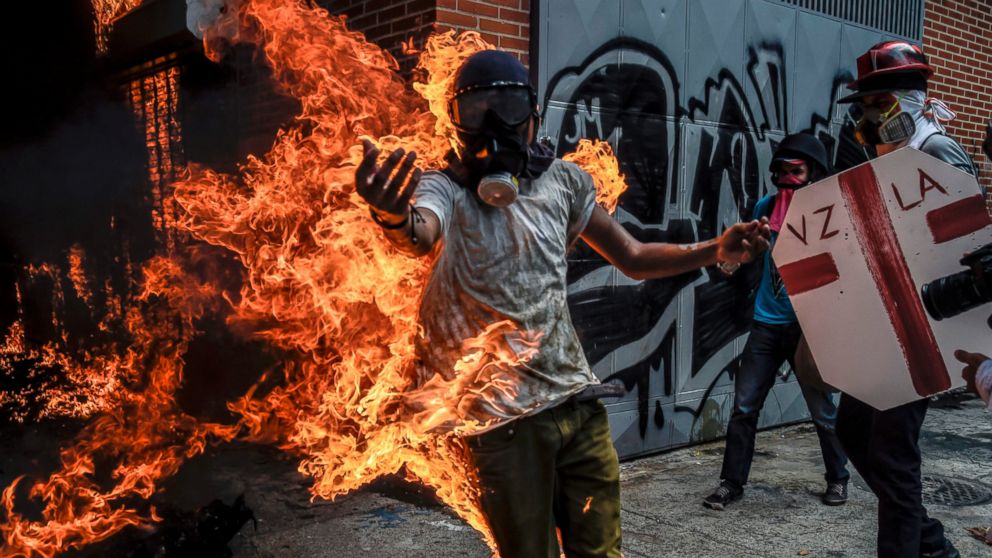 PHOTO: A demonstrator catches fire after the gas tank of a police motorbike exploded during clashes in a protest against Venezuelan President Nicolas Maduro, in Caracas on May 3, 2017.