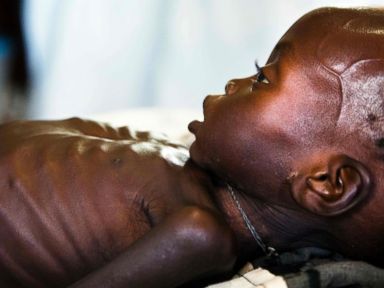 PHOTO: Child Refugees of War-Torn South Sudan