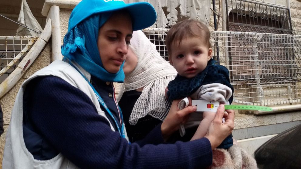 PHOTO: A photo released on Jan. 14, 2016 shows a UNICEF employee measuring the arm of a malnourished child in the besieged Syrian town of Madaya during an assessment of the health situation of residents of the famine-stricken town.