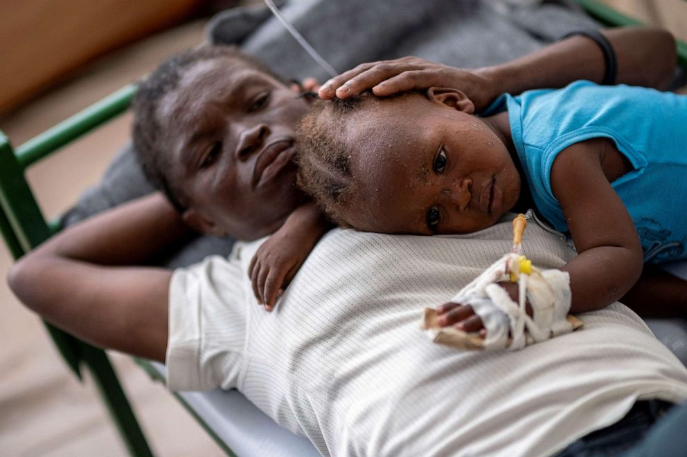 PHOTO: Karina Joseph, 19, comforts her 2-year-old child Holanda Sineus as she receives treatment for cholera in a tent at a Doctors Without Borders hospital in Cite Soleil, a densely populated commune of Port-au-Prince, Haiti, Octt. 15, 2022.