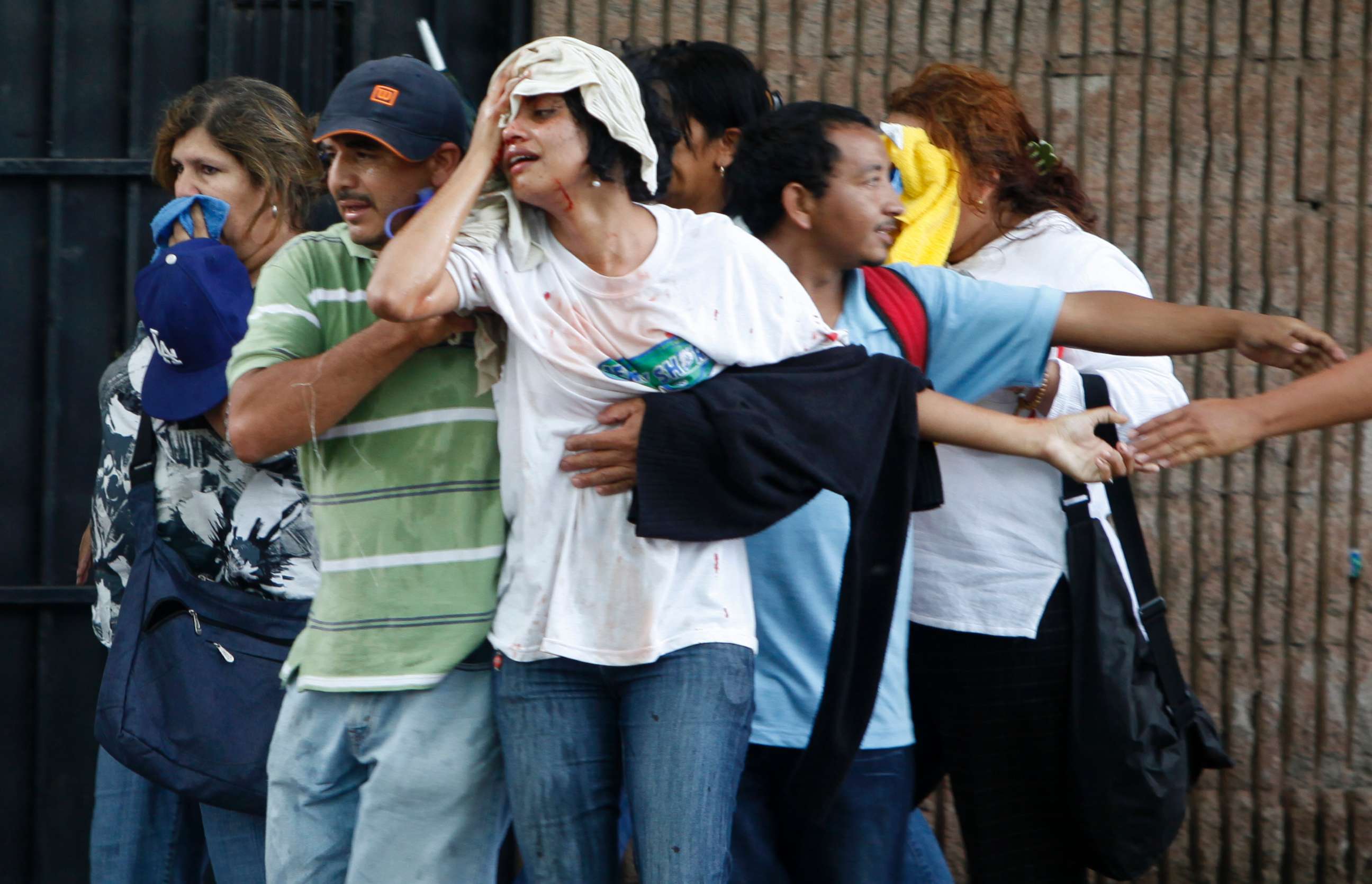 PHOTO: A wounded woman is taken away after violence broke out between soldiers and police against supporters of ousted Honduras' President Manuel Zelaya near the presidential residence in Tegucigalpa, June 29, 2009.