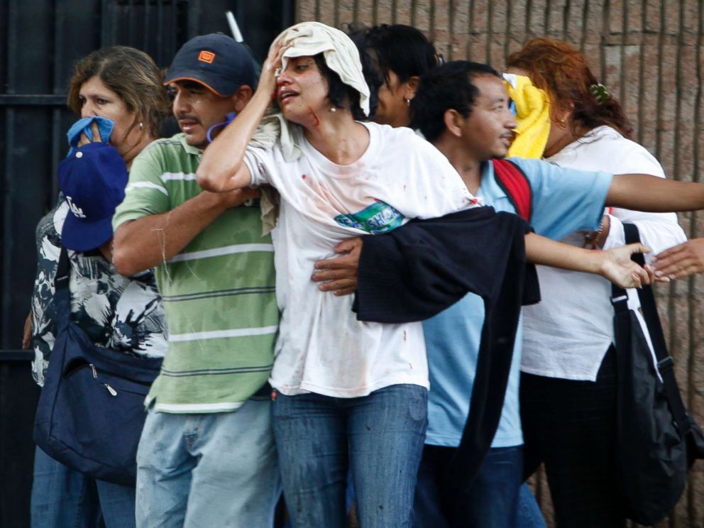 PHOTO: A wounded woman is taken away after violence broke out between soldiers and police against supporters of ousted Honduras President Manuel Zelaya near the presidential residence in Tegucigalpa, June 29, 2009.