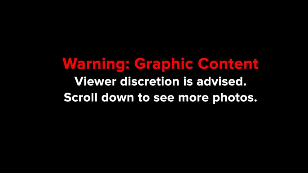 PHOTO: Warning: Graphic Content