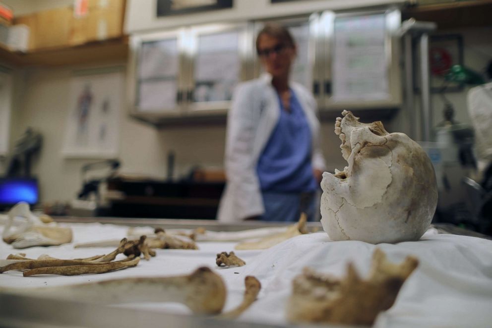 PHOTO: Forensic Anthropologist Dr Jennifer Vollner views the bones of a 16-20-year-old migrant from Mexico or Central America who died in the Sonoran Desert after crossing the U.S.-Mexico border, in Tucson, Pima County, Ariz., Sept. 12, 2018.