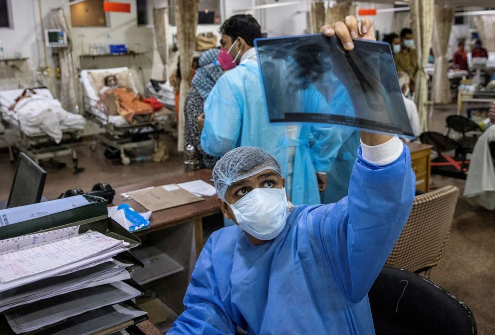 PHOTO: Rohan Aggarwal, 26, a resident doctor treating patients suffering from the coronavirus disease (COVID-19), looks at a patient's x-ray scan during his 27-hour shift at Holy Family Hospital in New Delhi, India, May 1, 2021.