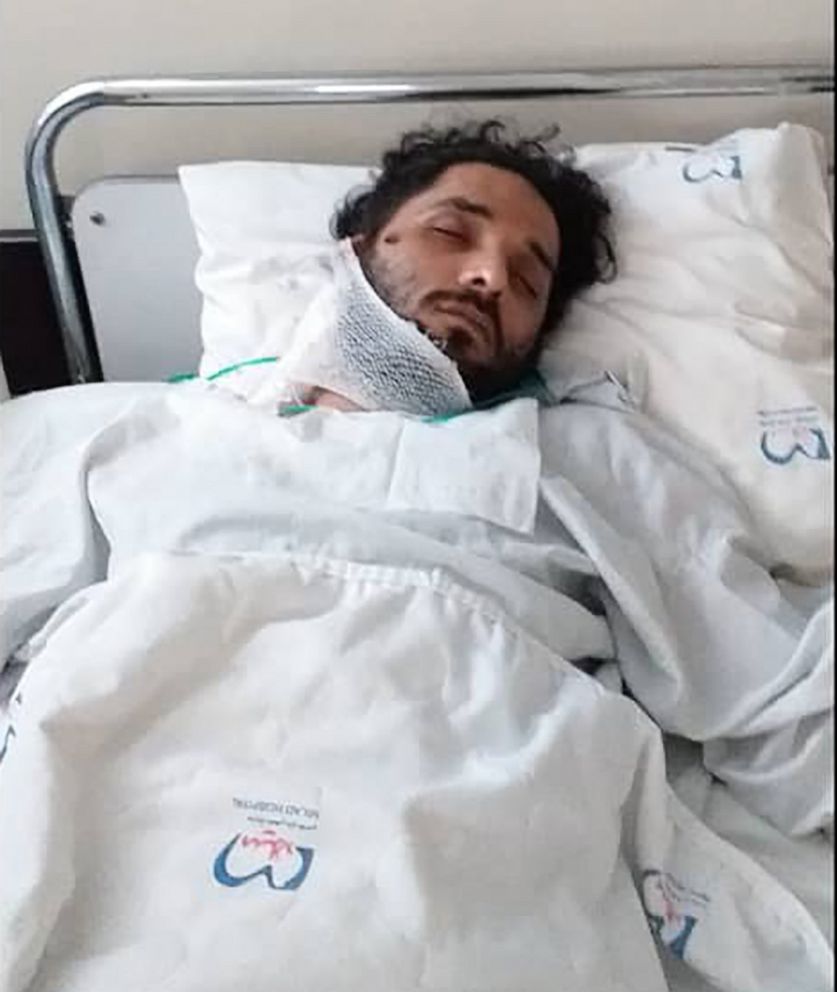PHOTO: Mahyar Ebrahimi was shot in the face during protests in Iran in November, 2019, and says he spent eight days in intensive care.
