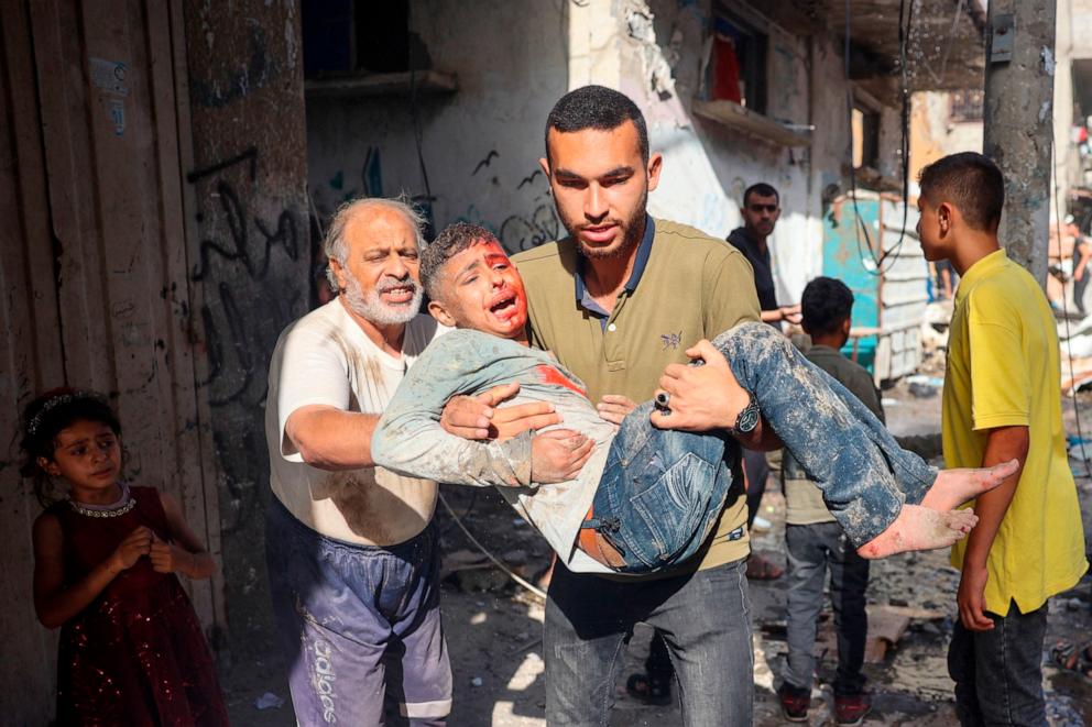 PHOTO: A man carries an injured child following Israeli bombardment at al-Bureij refugee camp in the central Gaza Strip on June 16, 2024.