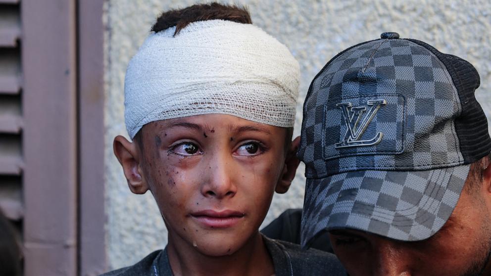 PHOTO: An injured child cries in the yard of the Al-Aqsa Martyrs hospital in Deir el-Balah in the central Gaza Strip, following an overnight Israeli strike, Aug. 10, 2024.