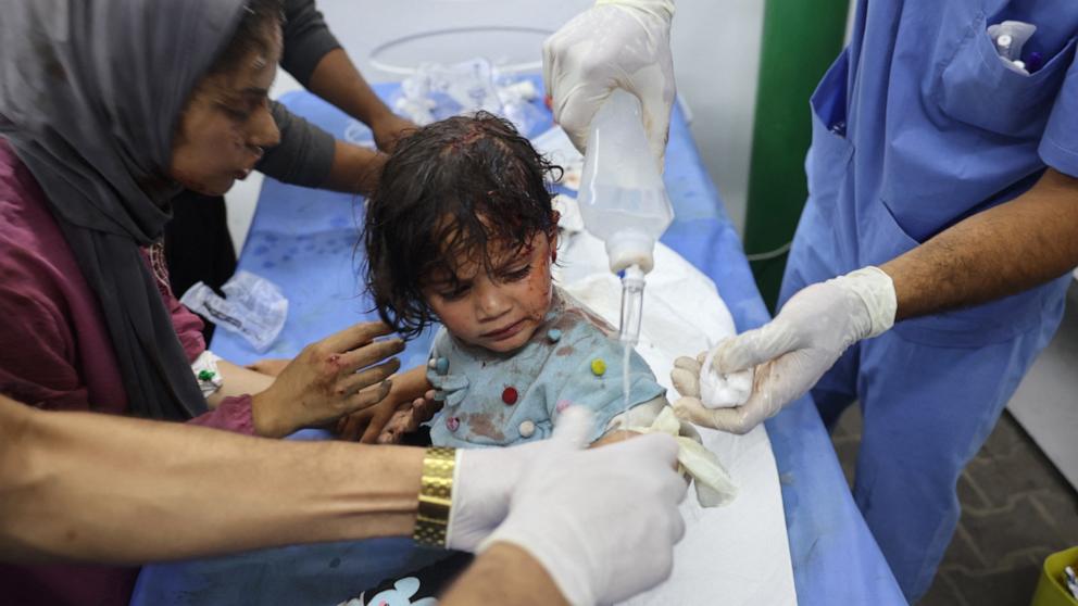PHOTO: A Palestinian girl, wounded in an Israeli strike on a camp for displaced Gazans, receives treatment at a hospital in Rafah, May 26, 2024.