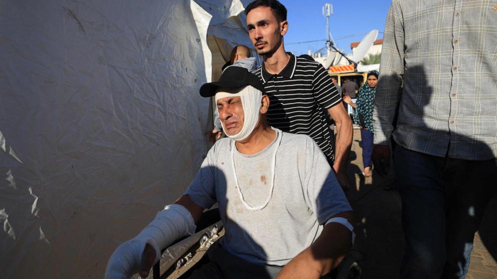 PHOTO: A Palestinian man wounded in Israeli bombardment reacts as he is wheeled outside Al-Aqsa hospital in Deir al-Balah in the center of the Gaza Strip, on Nov. 17, 2023.