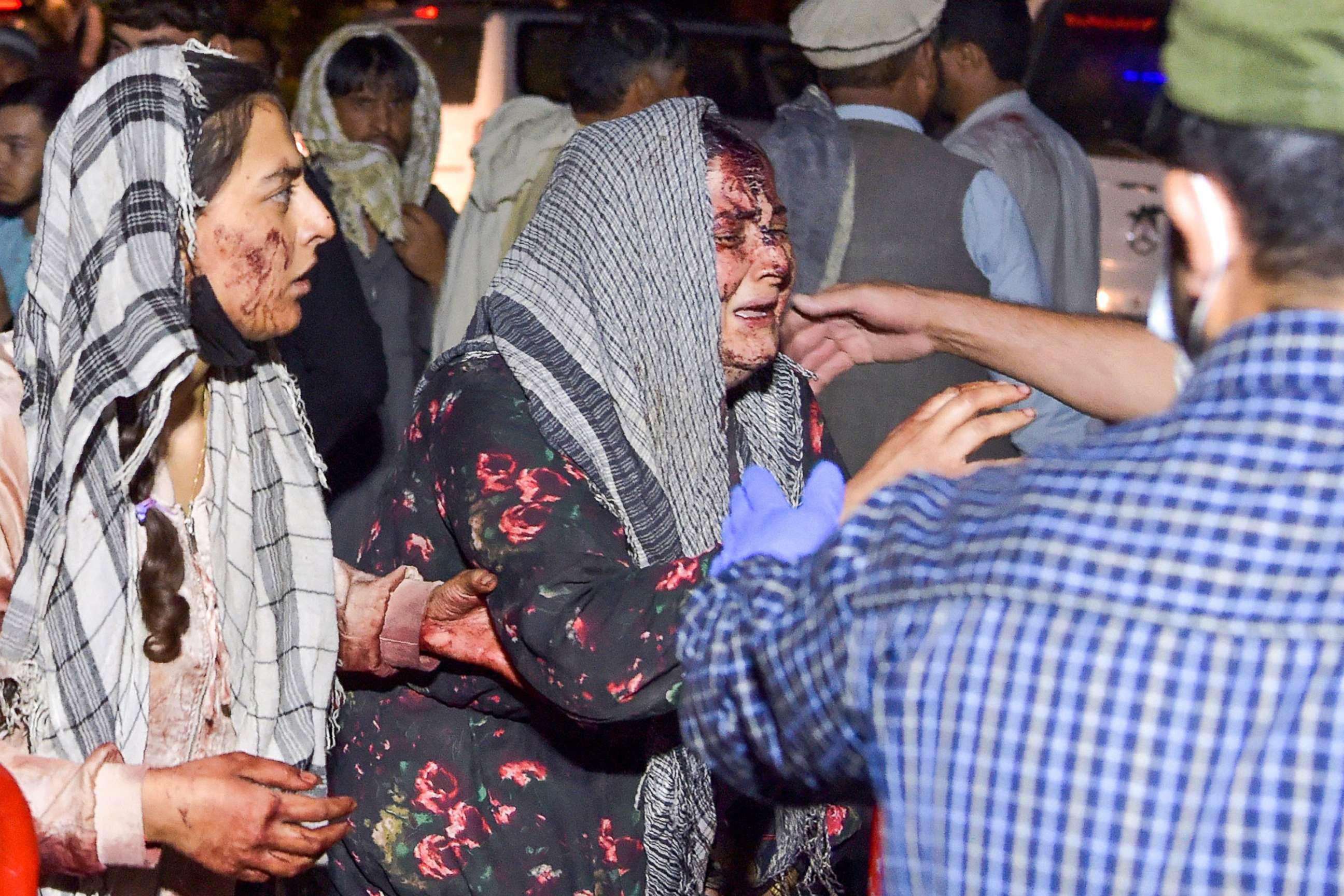 PHOTO: Wounded women arrive at a hospital for treatment after a bomb attack which left several dead and wounded outside the airport in Kabul, Afghanistan, Aug. 26, 2021.