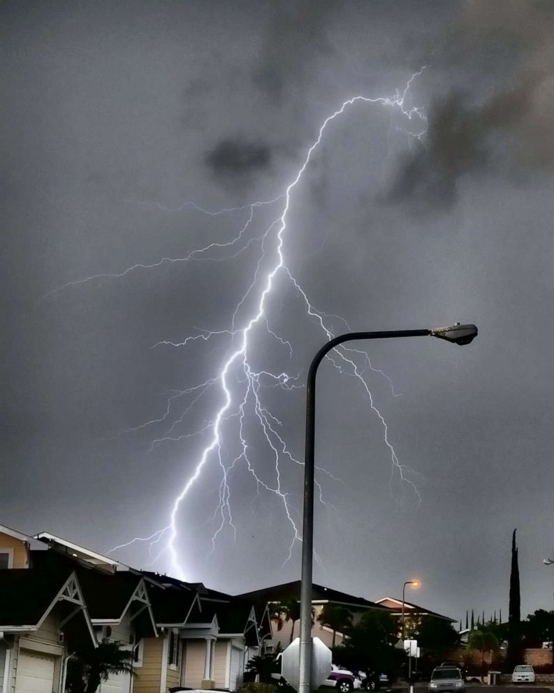 10-year-old boy grateful to survive being struck by lightning - ABC News