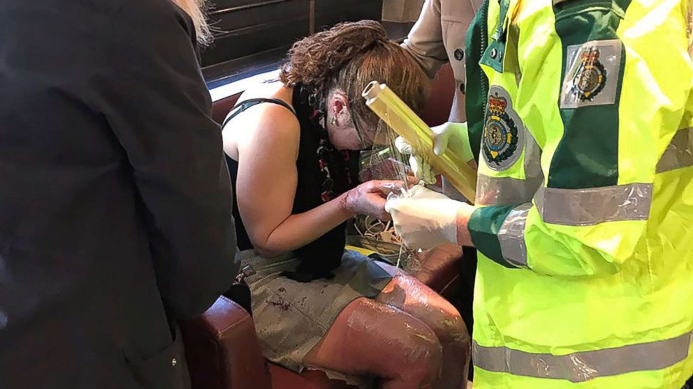 PHOTO: Emergency services tend to an injured woman following a blast on an underground train at Parsons Green tube station in West London, Sept. 15, 2017, in an image posted to social media.