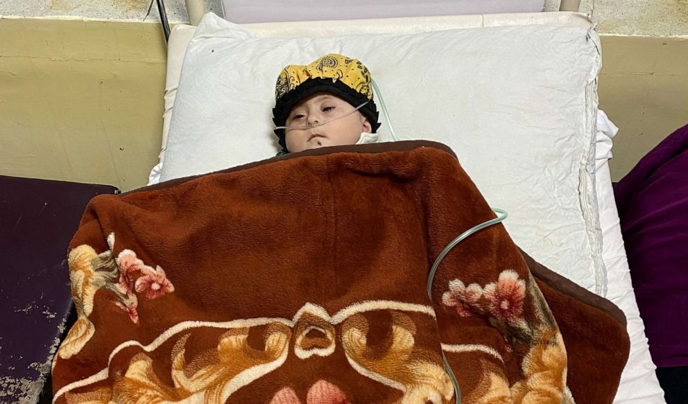 PHOTO: A child rests in a bed at Indira Gandhi Children's Hospital in Kabul.