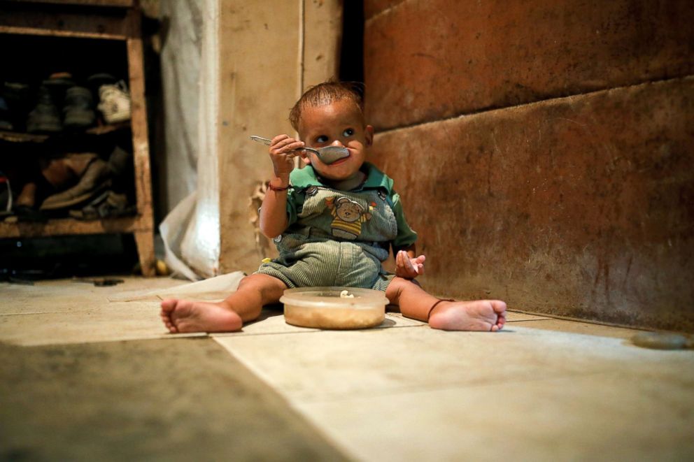 PHOTO: Yeibe Medina, the one-year old son of Maria Guitia sits on the floor feeding himself at their home near San Francisco de Yare, Venezuela, Feb. 18, 2019.