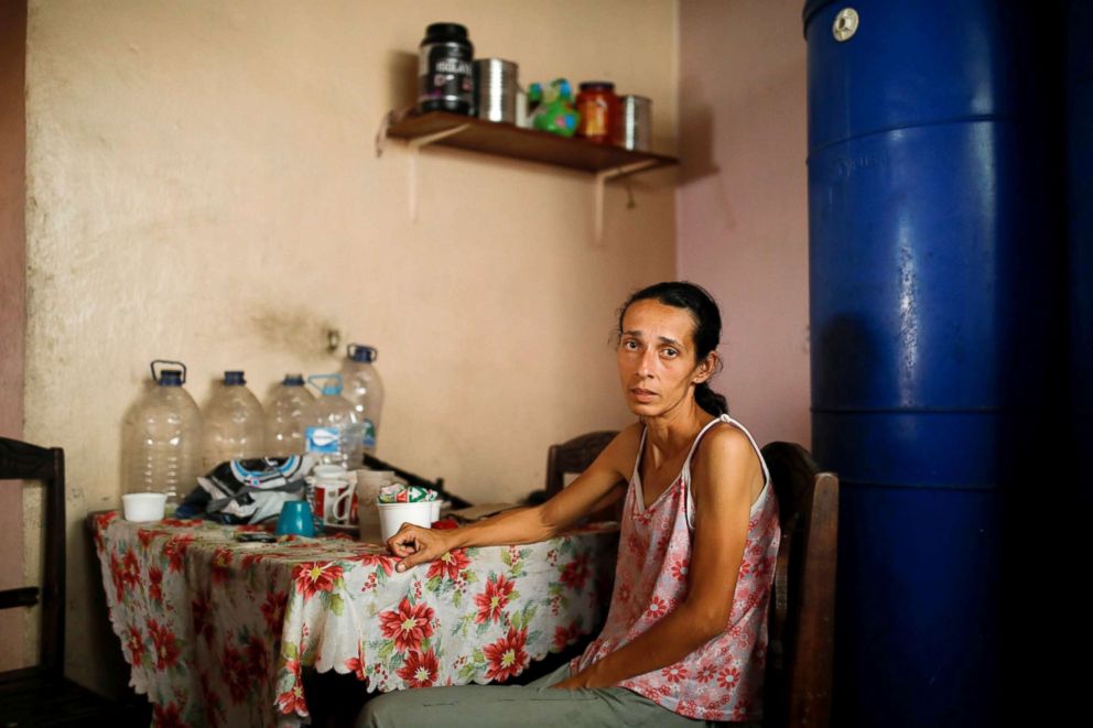 PHOTO: Yaneidi Guzman, 38, poses for a picture at her home in Caracas, Venezuela, Feb. 17, 2019.