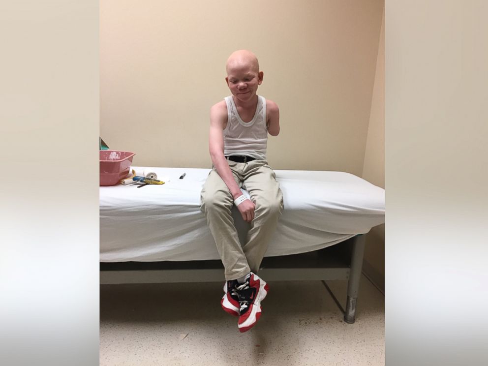 PHOTO: Mwigulu, a 14-year-old from Tanzania, whose arm was cut off because he has albinism, waits to be fitted with a new prosthetic arm at Shriners Hospital for Children.