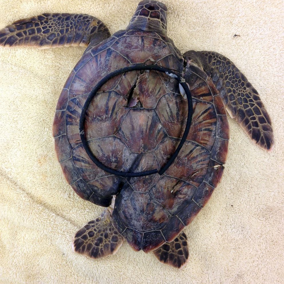PHOTO: A sea turtle deformed after being entangled in plastic, is treated at the Sea Turtle Hospital at University of Florida Whitney Laboratory.
