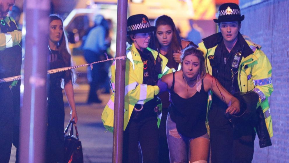 Police and other emergency services assist an injured woman near the Manchester Arena after reports of an explosion, May 22, 2017.