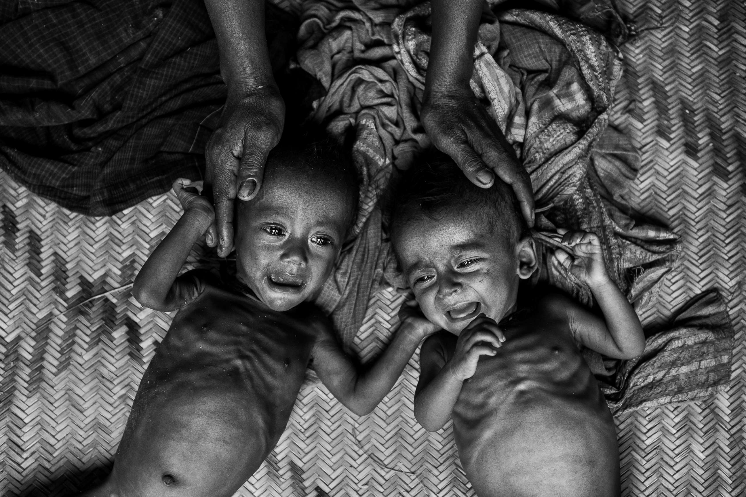 PHOTO: Malnourished and suffering from diarrhea, two Rohingya refugee children cry on the floor of a makeshift shelter at the Balukali refugee camp in Bangladesh, Sept. 27, 2017. 