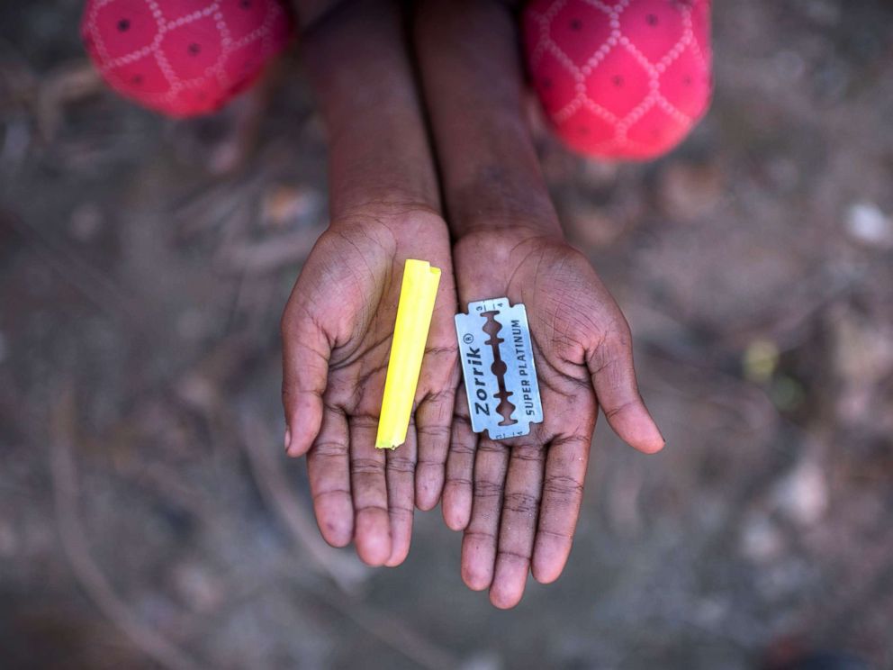 PHOTO: Rohingya migrant girl Halima Khatun (6), who arrived in Bangladesh in October, holds a whistle and a razor blade that she uses as toys at the Shamlapur refugee camp in Coxs Bazar, Dec. 1, 2017.