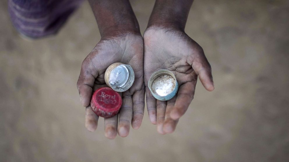 PHOTO: Rohingya migrant boy Abdul Hafez (5), who arrived in Bangladesh in September, holds bottle tops that he uses to play a game called 'Medakhela' at the Thankhali refugee camp in Cox's Bazar, Dec. 2, 2017.