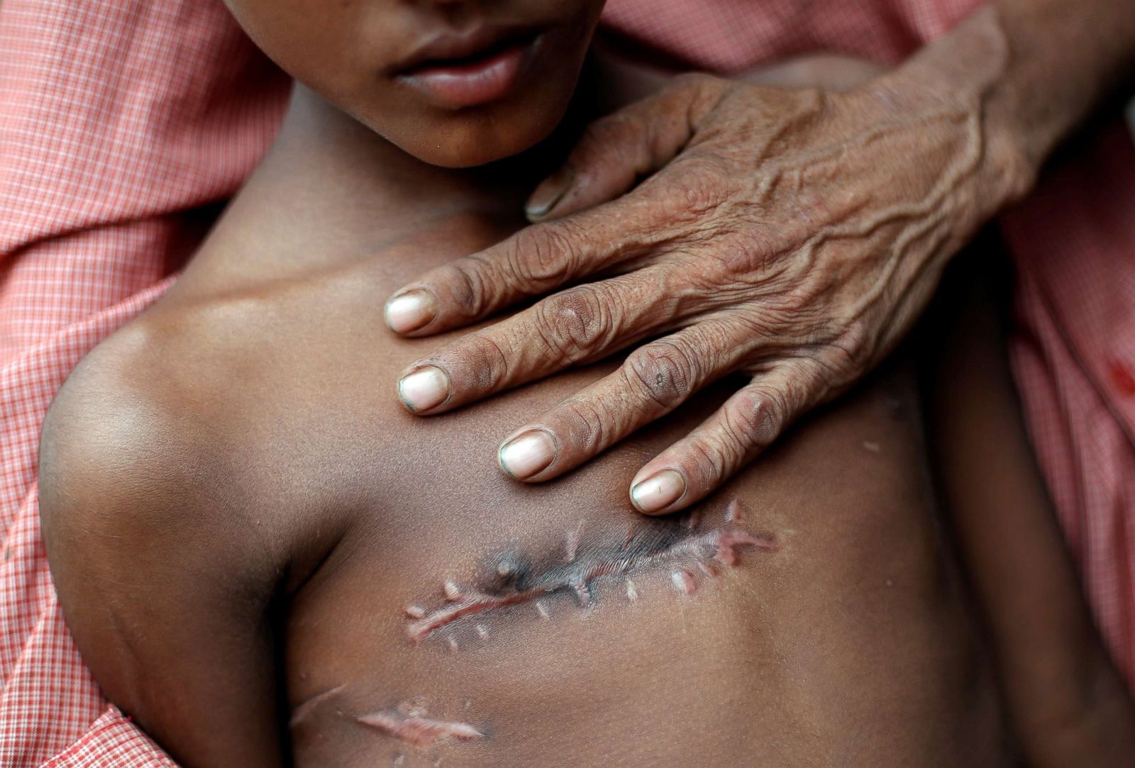 2018-pulitzer-prize-winners-in-photography-photos-abc-news