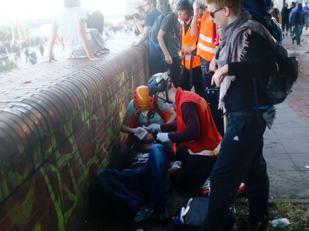 PHOTO: An injured protester gets help during the demonstration during the G-20 summit in Hamburg, Germany, July 6, 2017.