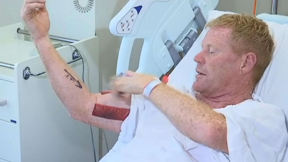 PHOTO: A 50-year-old former professional surfer was bitten by a shark at Samurai Beach in New South Wales, Australia, on Saturday, Oct. 20. 
