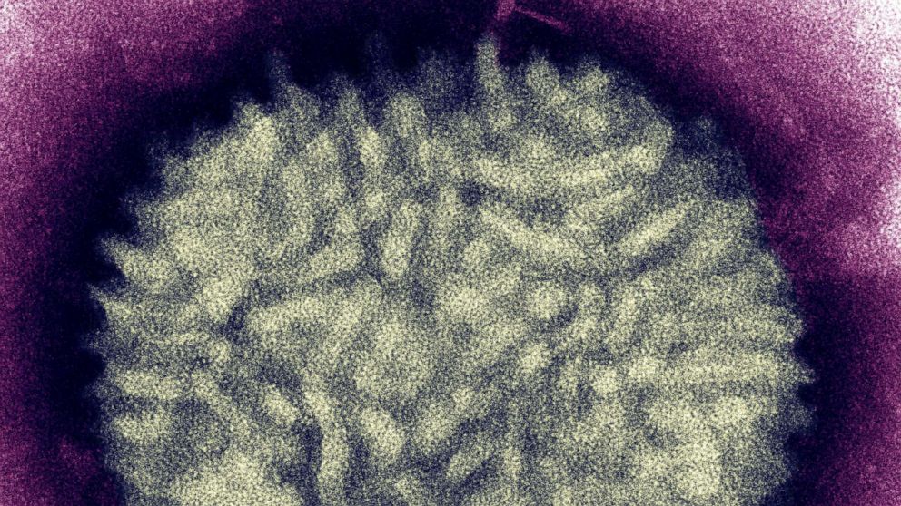 PHOTO: An electron micrograph of a vaccinia virus that is used in the vaccine to protect people from the smallpox virus.