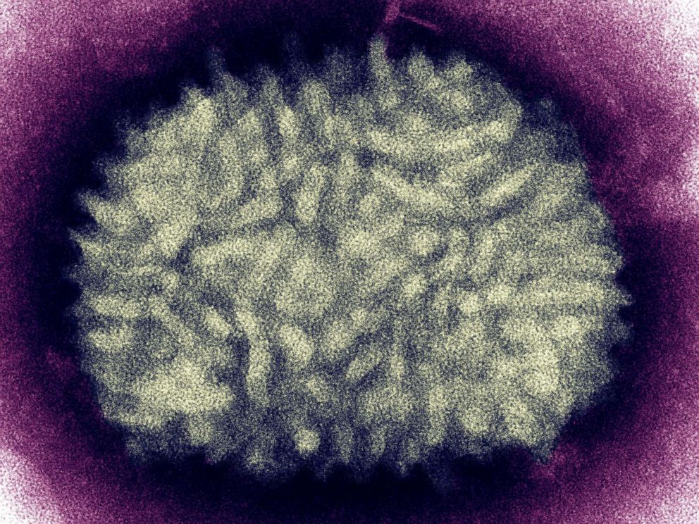 PHOTO: Electron micrograph of a vaccinia virus used in the vaccine to protect people from the smallpox virus.