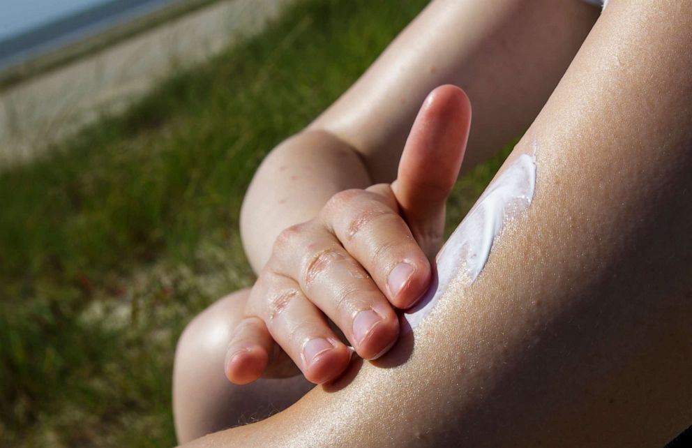 PHOTO: An undated photo shows a woman applying sunscreen on her arm in Sonderho, Denmark.