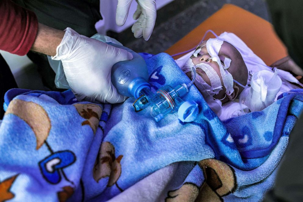 PHOTO: An infant rescued from the wreckage of the earthquake receives medical treatment while being transported to a hospital in Bab al-Hawa in Syria's northwestern Idlib province, on Feb. 12, 2023.