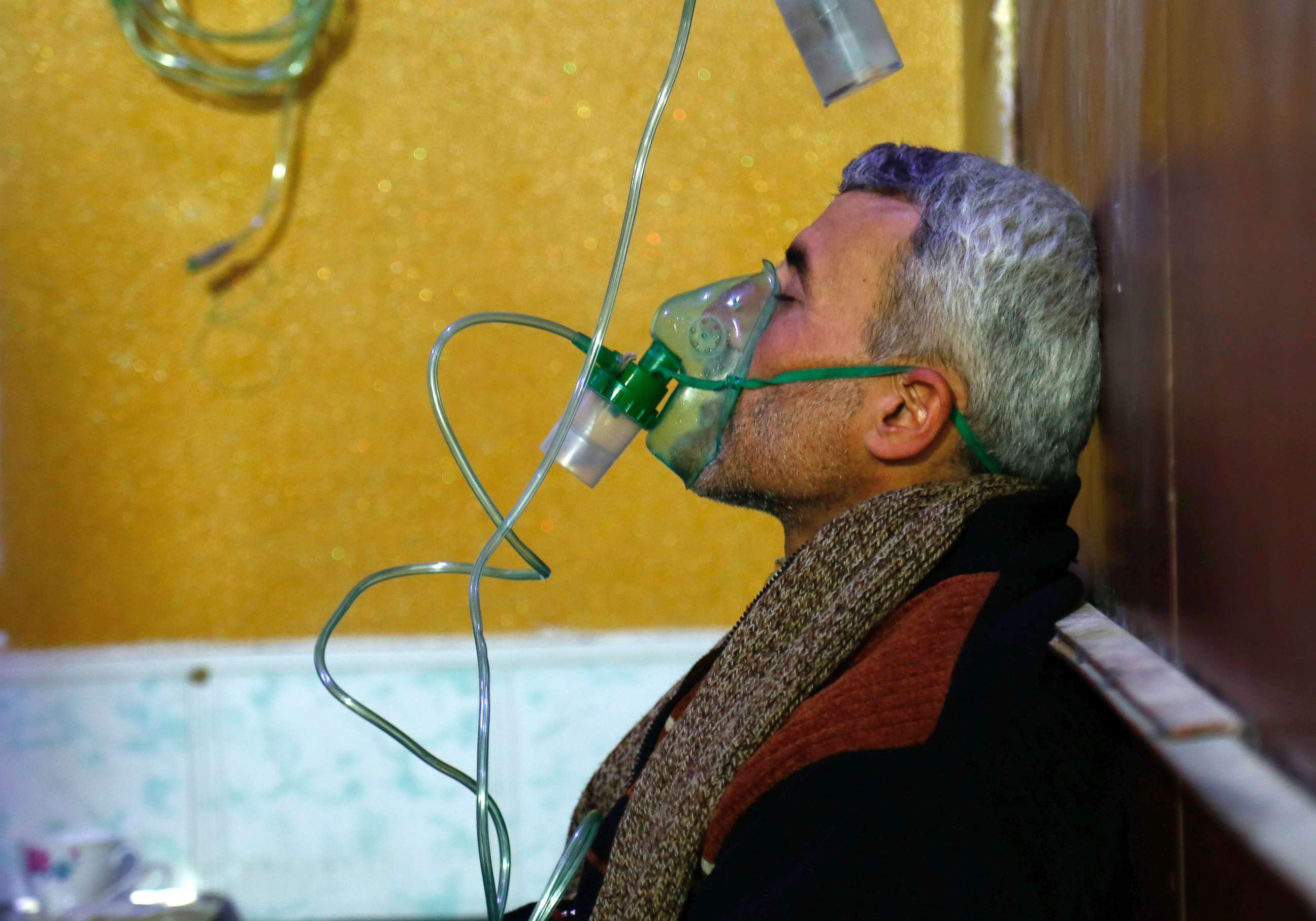 PHOTO: A Syrian man wears an oxygen mask at a makeshift hospital following a reported gas attack on the rebel-held besieged town of Douma in the eastern Ghouta region on the outskirts of the capital Damascus on Jan. 22, 2018. 

