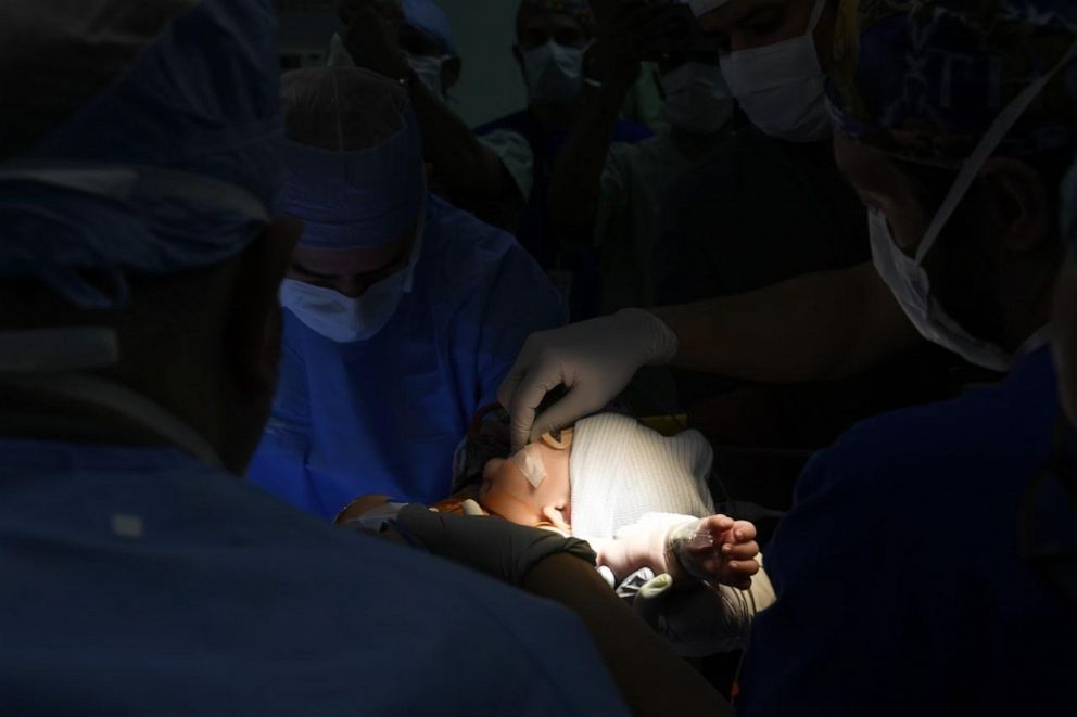 PHOTO: Doctors operate on one of the conjoined Libyan twins at the King Abdullah Specialist Children’s Hospital in Riyadh.