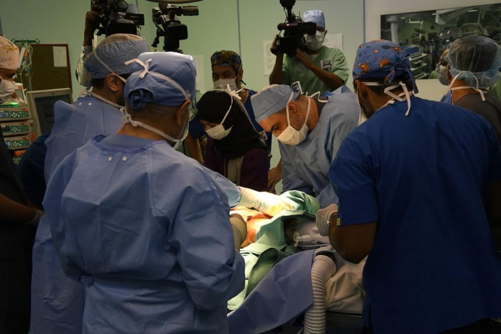 PHOTO: Doctors operate on Libyan conjoined twins Ahmed and Muhammad at the King Abdullah Specialist Children’s Hospital in Riyadh.