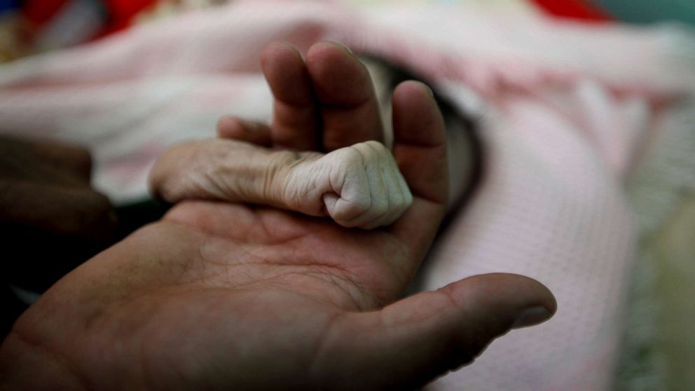Saleh Hassan al-Faqeh holds the hand of his four-month-old daughter, Hajar, who died of malnutrition at the al-Sabeen hospital in Sanaa, Yemen, Nov. 15, 2018. "She was like skin on bones, her body was emaciated," he said.