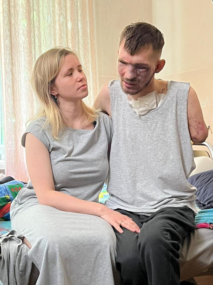 PHOTO: Alina and Andriy Smolensky sat down with ABC News' Foreign Correspondent James Longman in Kyiv on 21 July, 2023. Andriy lost both his arms, and his eyesight, when a shell exploded in front of him while in the trenches in the spring.