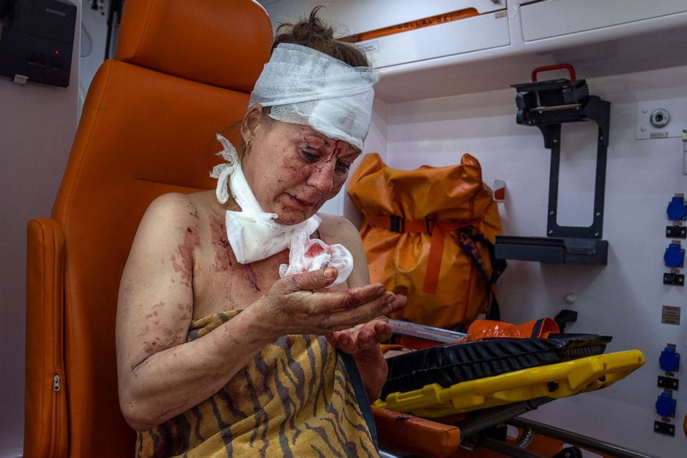 PHOTO: An injured woman looks at her wounds in an ambulance after a strike in a residential area, in Kramatorsk, Donetsk region, eastern Ukraine, July 7, 2022.