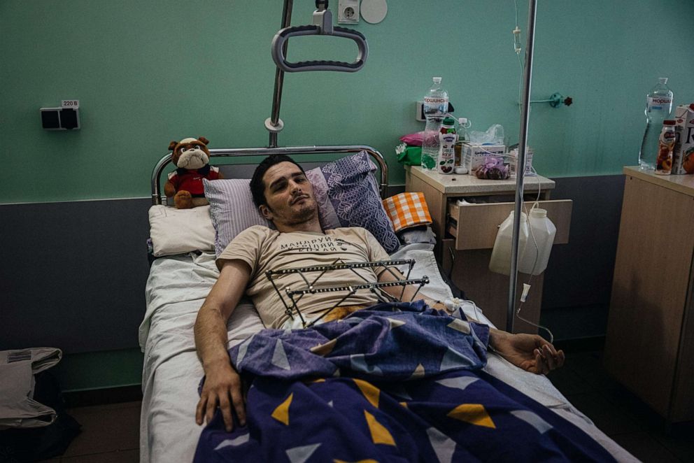 PHOTO: Ukrainian soldier Glib Stryzhko, 25, lies in a hospital bed in Zaporizhzhia, Ukraine on May 7, 2022.
