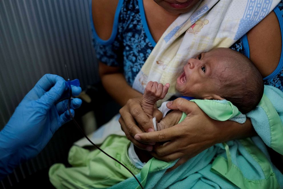 PHOTO: Francys Rivero holds her two-month-old son Kenai, who has been diagnosed with malnutrition, while he receives a blood test at a clinic in Barquisimeto, Venezuela, Aug. 14, 2019.