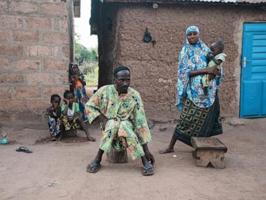 Childhood Stunting in Benin The Economics of Informational Friction and Nutritional Deficit